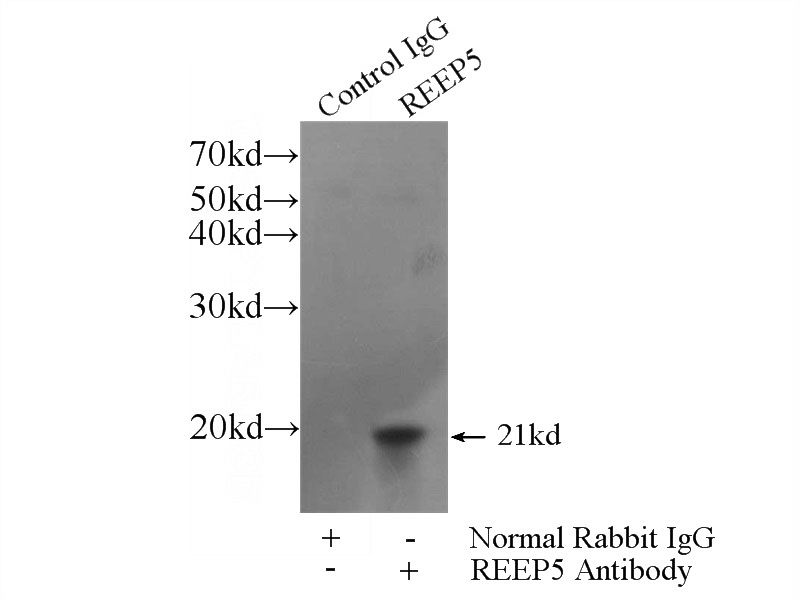 IP Result of anti-REEP5 (IP:Catalog No:114681, 3ug; Detection:Catalog No:114681 1:1000) with HeLa cells lysate 2400ug.