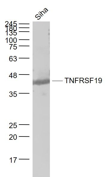 Fig1: Sample:; Siha(Human) Cell Lysate at 30 ug; Primary: Anti- TNFRSF19 at 1/1000 dilution; Secondary: IRDye800CW Goat Anti-Rabbit IgG at 1/20000 dilution; Predicted band size: 43 kD; Observed band size: 43 kD