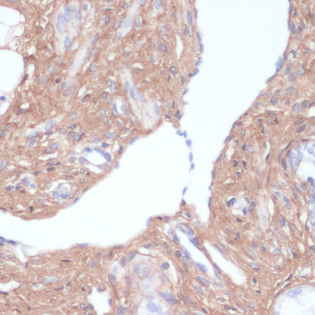 Immunohistochemistry - COL1A1 Polyclonal Antibody 