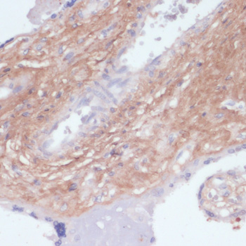 Immunohistochemistry - COL1A1 Polyclonal Antibody 
