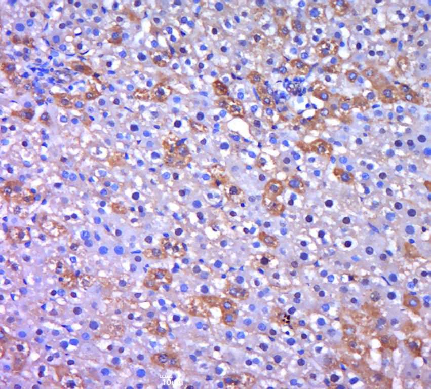 Fig2: Paraformaldehyde-fixed, paraffin embedded (rat liver tissue); Antigen retrieval by boiling in sodium citrate buffer (pH6.0) for 15min; Block endogenous peroxidase by 3% hydrogen peroxide for 20 minutes; Blocking buffer (normal goat serum) at 37℃ for 30min; Antibody incubation with (NIT2) Polyclonal Antibody, Unconjugated at 1:400 overnight at 4℃, followed by a conjugated secondary (sp-0023) for 20 minutes and DAB staining.
