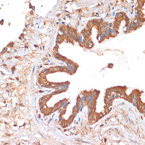 Immunohistochemistry - HHLA2 Polyclonal Antibody 