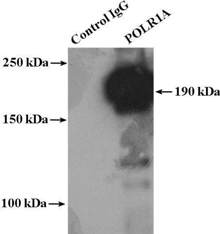 IP Result of anti-RPA1 (IP:Catalog No:114034, 4ug; Detection:Catalog No:114034 1:300) with HeLa cells lysate 2400ug.
