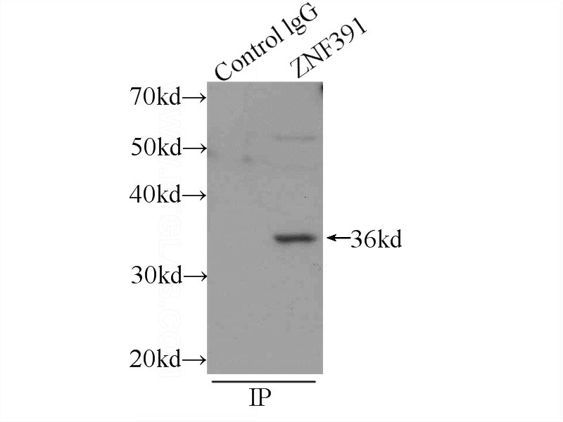 IP Result of anti-ZNF391 (IP:Catalog No:117170, 3ug; Detection:Catalog No:117170 1:300) with mouse testis tissue lysate 4000ug.