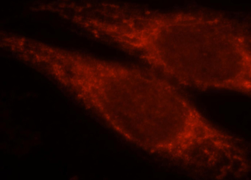 Immunofluorescent analysis of Hela cells, using RAB3IL1 antibody Catalog No:114447 at 1:25 dilution and Rhodamine-labeled goat anti-rabbit IgG (red).