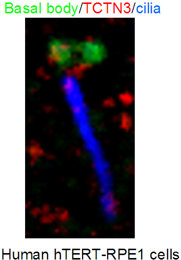 IF result from Dr. Corbit, Kevin. anti-TCTN3(Catalog No:115921) mark the transition zone of Human hTERT-RPE1 cells.