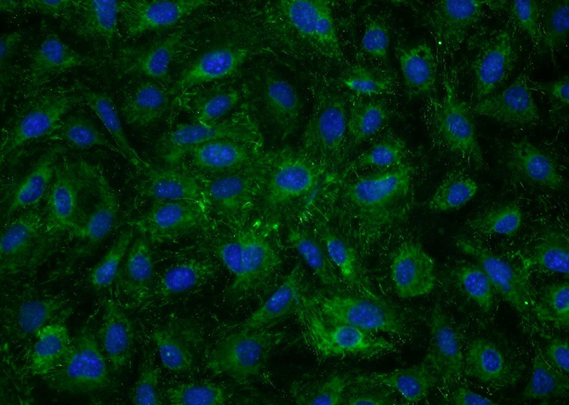 Immunofluorescent analysis of NIH/3T3 cells using Catalog No:110659(FN1 Antibody) at dilution of 1:50 and Alexa Fluor 488-congugated AffiniPure Goat Anti-Rabbit IgG(H+L)