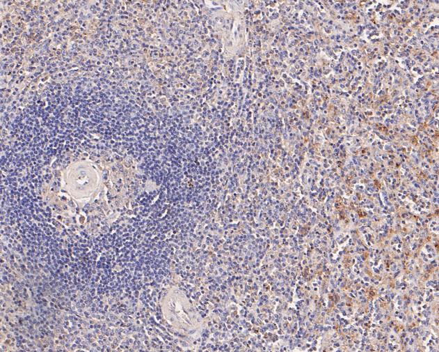 Fig3:; Immunohistochemical analysis of paraffin-embedded human spleen tissue using anti-CD68 antibody. The section was pre-treated using heat mediated antigen retrieval with Tris-EDTA buffer (pH 8.0-8.4) for 20 minutes.The tissues were blocked in 5% BSA for 30 minutes at room temperature, washed with ddH; 2; O and PBS, and then probed with the primary antibody ( 1/200) for 30 minutes at room temperature. The detection was performed using an HRP conjugated compact polymer system. DAB was used as the chromogen. Tissues were counterstained with hematoxylin and mounted with DPX.