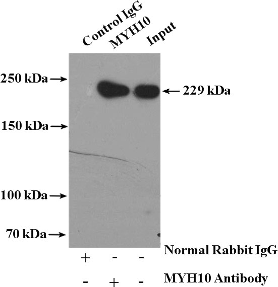 IP Result of anti-MYH10-Specific (IP:Catalog No:112930, 4ug; Detection:Catalog No:112930 1:1000) with mouse brain tissue lysate 4000ug.