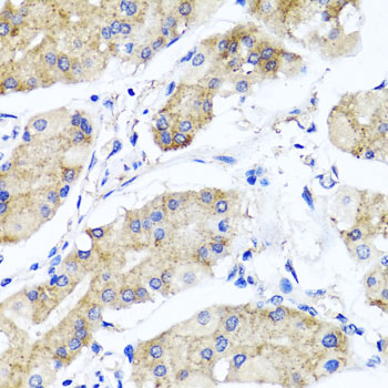 Immunohistochemistry - PSTPIP1 Polyclonal Antibody 