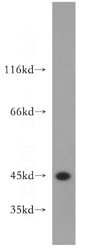 human brain tissue were subjected to SDS PAGE followed by western blot with Catalog No:109069(CCNI2 antibody) at dilution of 1:500