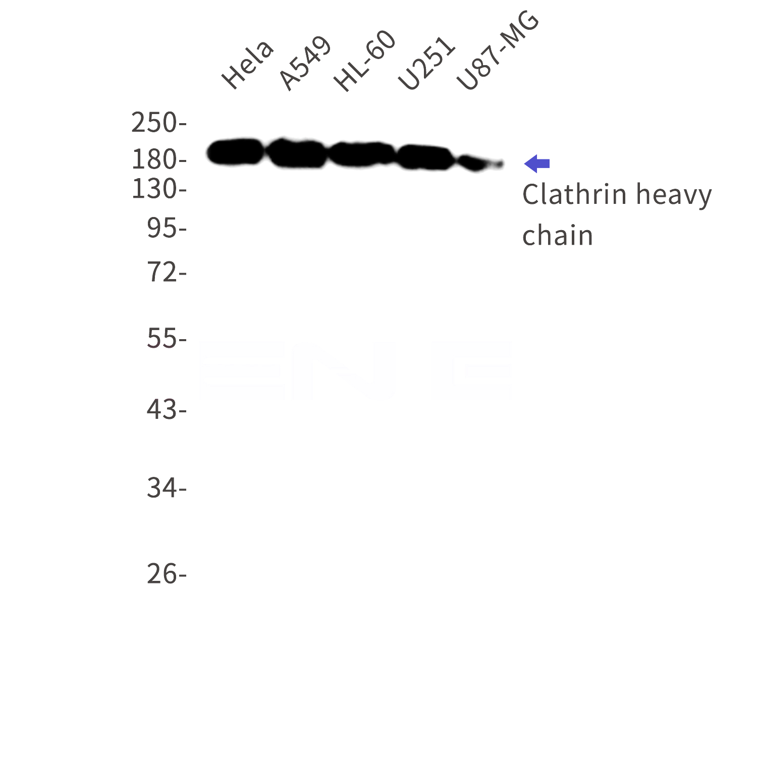 Western blot detection of Clathrin heavy chain in Hela,A549,HL-60,U251,U87-MG cell lysates using Clathrin heavy chain Rabbit mAb(1:1000 diluted).Predicted band size:192kDa.Observed band size:192kDa.