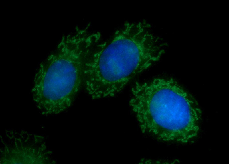 Immunofluorescent analysis of HepG2 cells using Catalog No:117101(BCL3 Antibody) at dilution of 1:50 and Alexa Fluor 488-congugated AffiniPure Goat Anti-Rabbit IgG(H+L)
