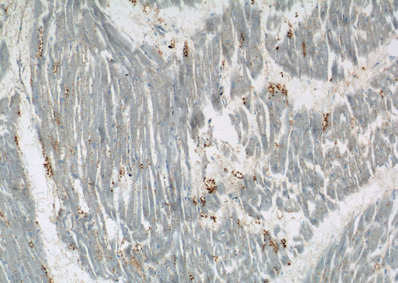 Immunohistochemistry of paraffin-embedded human heart tissue slide using Catalog No:117191(BLVRB Antibody) at dilution of 1:50 (under 10x lens)