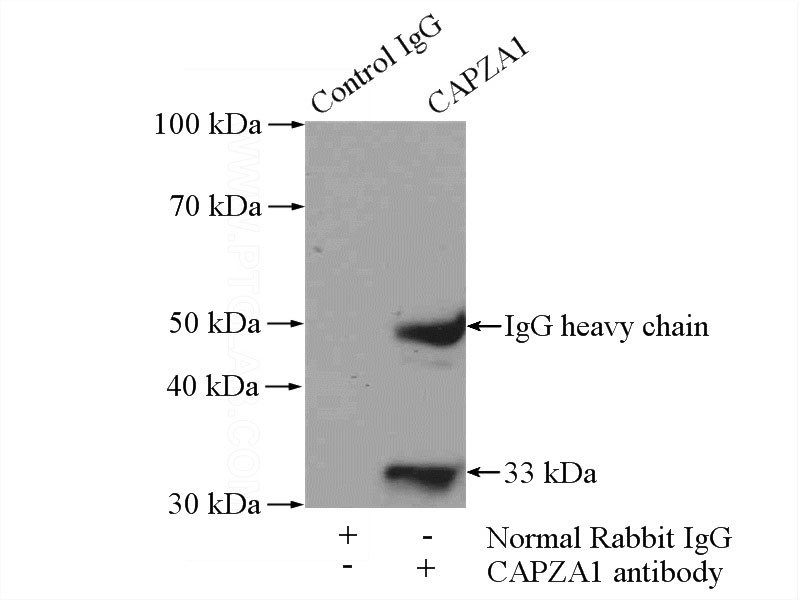 IP Result of anti-CAPZA1 (IP:Catalog No:108843, 4ug; Detection:Catalog No:108843 1:300) with SH-SY5Y cells lysate 3000ug.