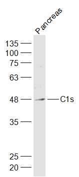 Fig1: Sample:; Pancreas (Mouse) Lysate at 40 ug; Primary: Anti-C1s at 1/1000 dilution; Secondary: IRDye800CW Goat Anti-Rabbit IgG at 1/20000 dilution; Predicted band size: 47/75 kD; Observed band size: 47 kD