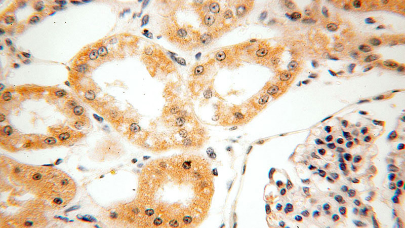 Immunohistochemical of paraffin-embedded human kidney using Catalog No:111303(HEXB antibody) at dilution of 1:50 (under 40x lens)
