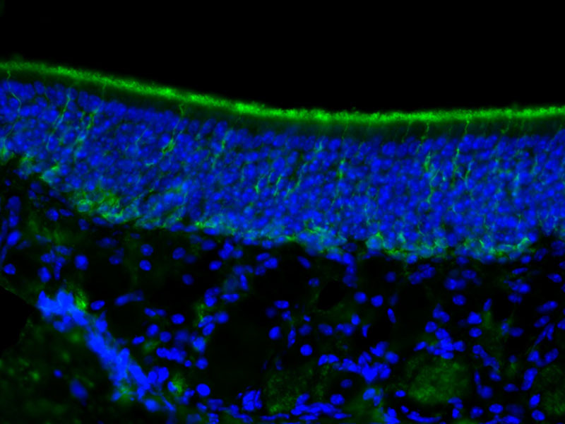Fluorescent IHC on 1%PLP fixed frozen mouse olfactory epithelium tissue of STMN1 antibody (Catalog No:, 1:200). Basal cell staining and dendritic processes as expected. By Dr. Brian Lin (Schwob Lab).