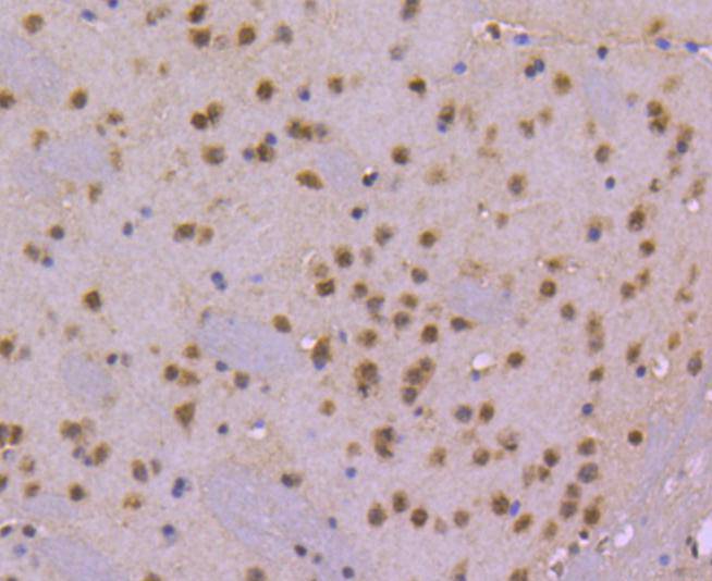 Fig7: Immunohistochemical analysis of paraffin-embedded mouse brain tissue using anti-CDC40 antibody. Counter stained with hematoxylin.