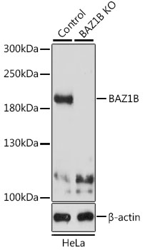 Western blot - BAZ1B Polyclonal Antibody 