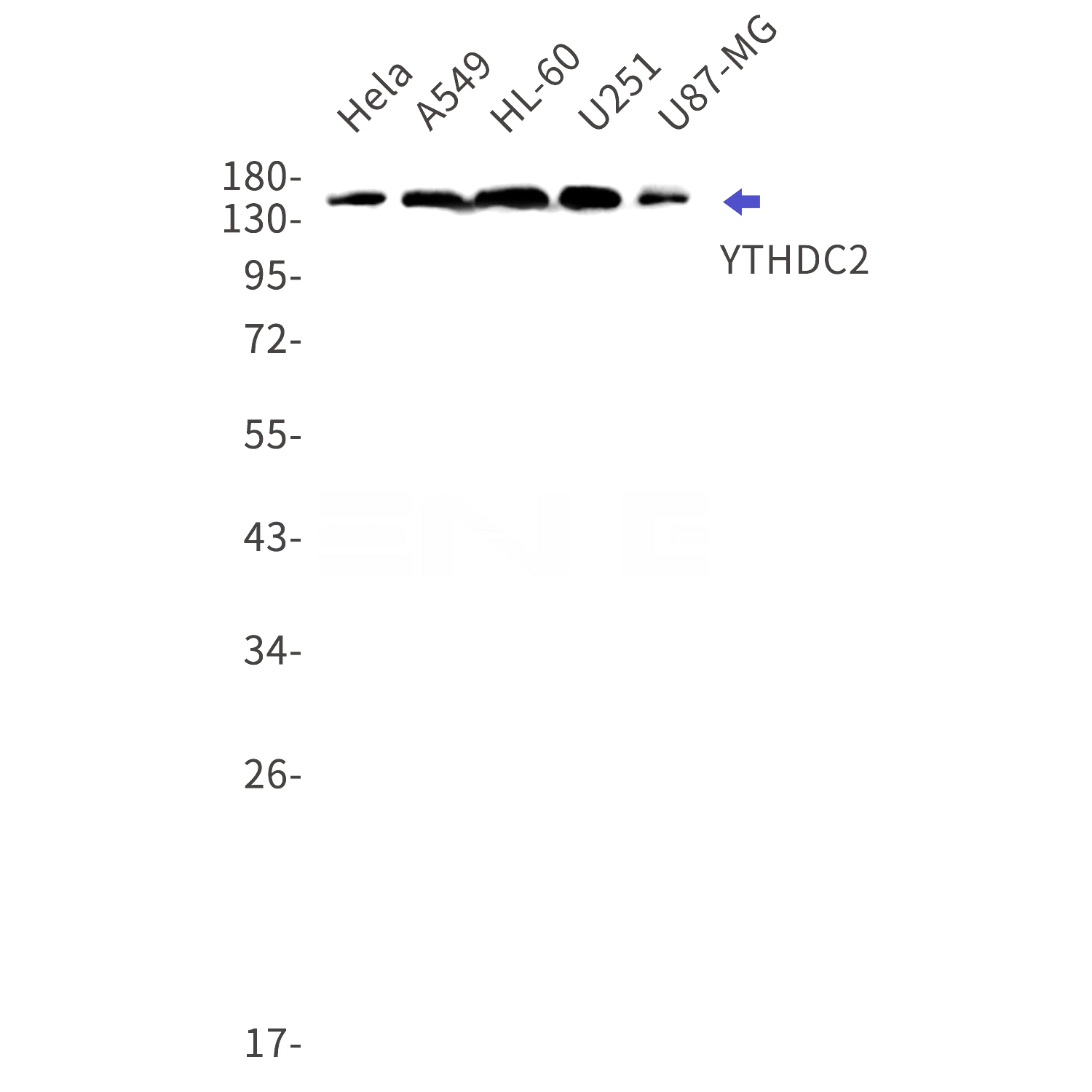 Western blot detection of YTHDC2 in Hela,A549,HL-60,U251,U87-MG cell lysates using YTHDC2 Rabbit mAb(1:1000 diluted).Predicted band size:160kDa.Observed band size:160kDa.