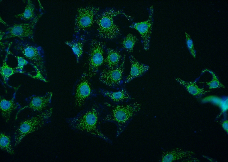 Immunofluorescent analysis of SH-SY5Y cells using Catalog No:112584(MED15 Antibody) at dilution of 1:50 and Alexa Fluor 488-congugated AffiniPure Goat Anti-Rabbit IgG(H+L)