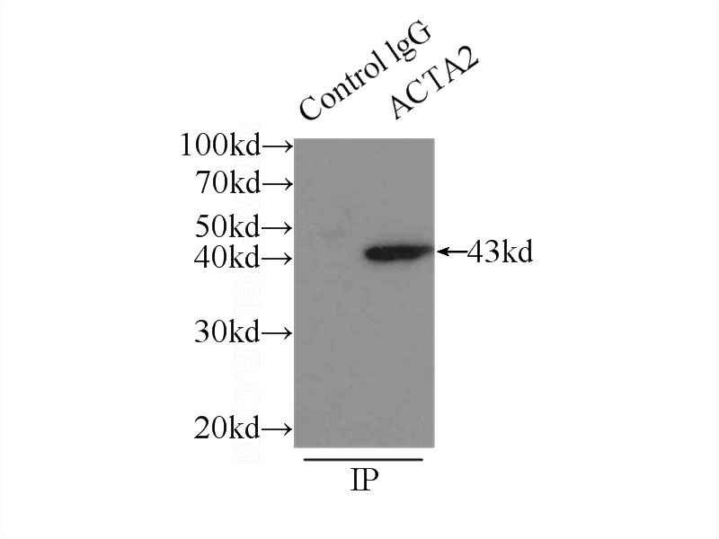 IP Result of anti-ACTA2 (IP:Catalog No:107705, 3ug; Detection:Catalog No:107705 1:1000) with mouse liver tissue lysate 6000ug.