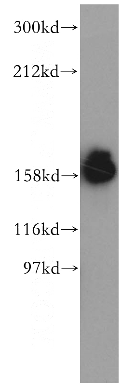 HeLa cells were subjected to SDS PAGE followed by western blot with Catalog No:112245(PPFIA1 antibody) at dilution of 1:500