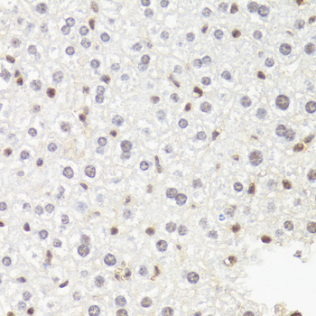 Immunohistochemistry - POLR2B Polyclonal Antibody 