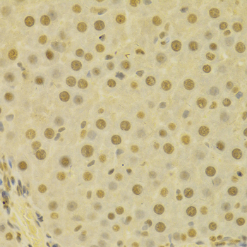 Immunohistochemistry - COPS5 Polyclonal Antibody 