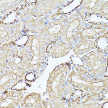 Immunohistochemistry - OPRK1 Polyclonal Antibody 