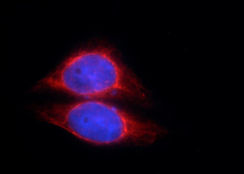 Immunofluorescent analysis of HepG2 cells using Catalog No:107565(AK2 Antibody) at dilution of 1:50 and Rhodamine-Goat anti-Mouse IgG