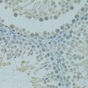 Immunohistochemistry - CTAG1B Polyclonal Antibody 