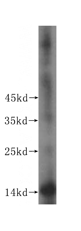 mouse testis tissue were subjected to SDS PAGE followed by western blot with Catalog No:115957(TEX12 antibody) at dilution of 1:400