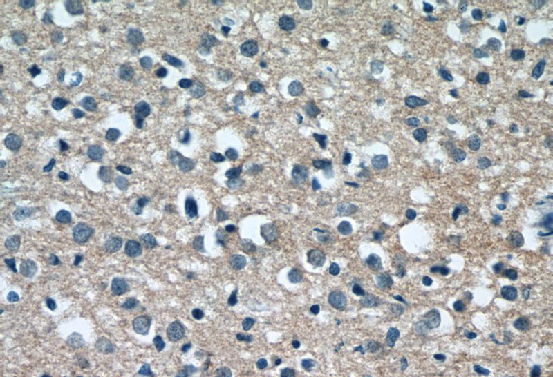 Immunohistochemistry of paraffin-embedded human brain tissue slide using Catalog No:114658(RHOB Antibody) at dilution of 1:50 (under 40x lens)