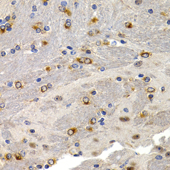 Immunohistochemistry - TFF1 Polyclonal Antibody 