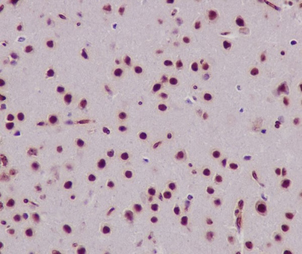 Immunohistochemical analysis of paraffin-embedded mouse brain, using Histone H3 Antibody.