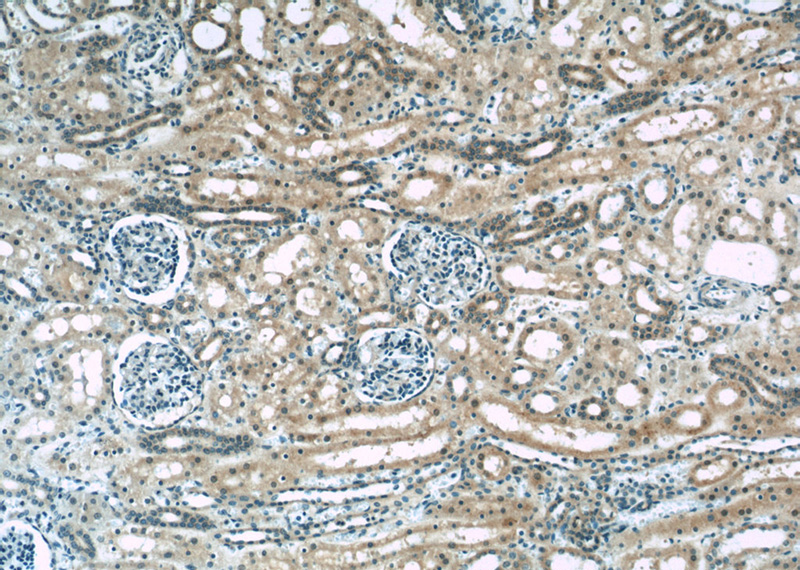 Immunohistochemistry of paraffin-embedded human kidney slide using Catalog No:111105(GNA14 Antibody) at dilution of 1:50
