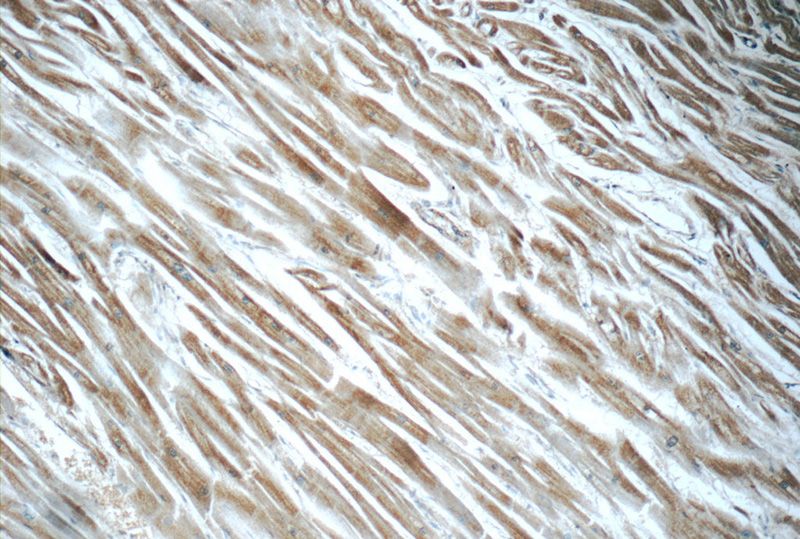 Immunohistochemistry of paraffin-embedded human heart tissue slide using Catalog No:108872(Caspase 12 Antibody) at dilution of 1:50 (under 10x lens)