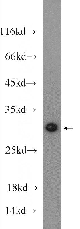 mouse heart tissue were subjected to SDS PAGE followed by western blot with Catalog No:112885(MTX2 Antibody) at dilution of 1:600