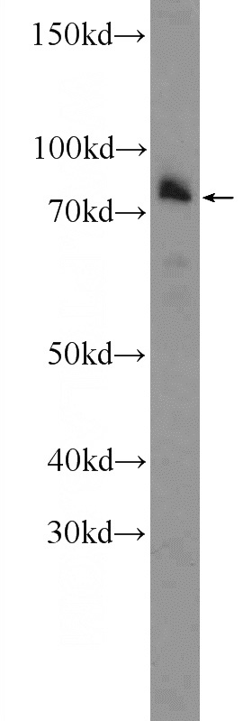 mouse embryo tissue were subjected to SDS PAGE followed by western blot with Catalog No:114261(PTCD3 Antibody) at dilution of 1:600