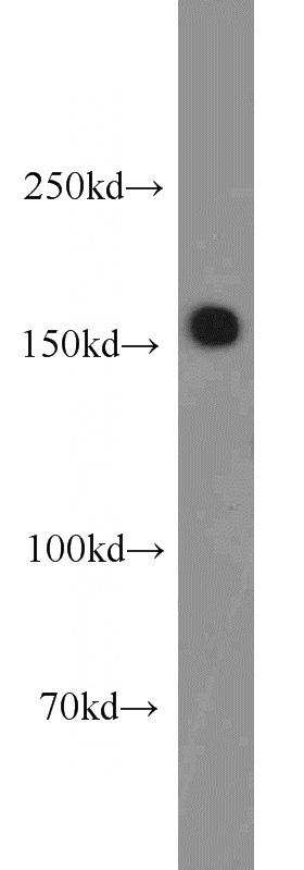 mouse brain tissue were subjected to SDS PAGE followed by western blot with Catalog No:115069(ZFYVE9 antibody) at dilution of 1:1000