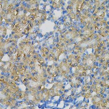 Immunohistochemistry - INPP5J Polyclonal Antibody 