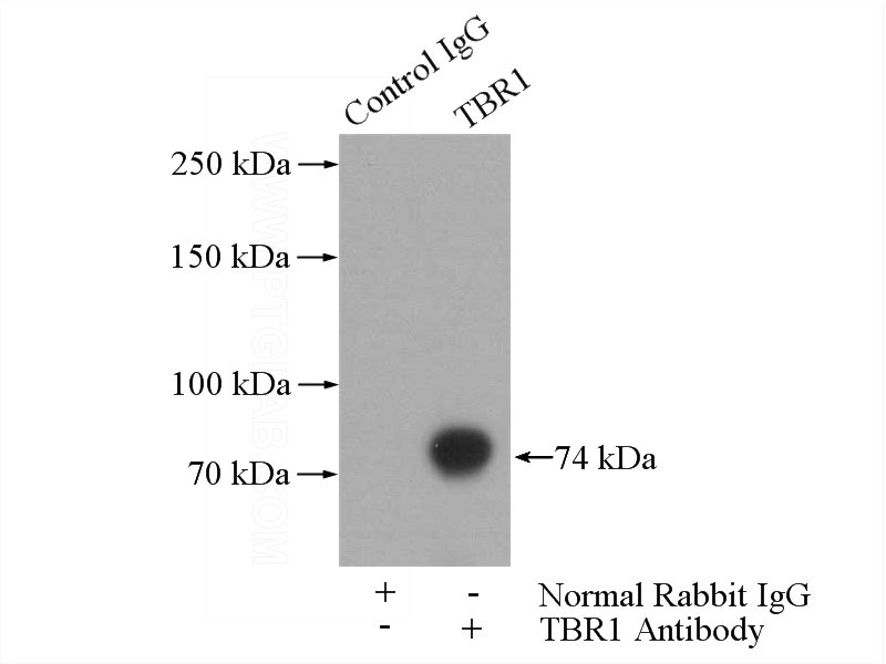 IP Result of anti-TBR1 (IP:Catalog No:115881, 4ug; Detection:Catalog No:115881 1:600) with mouse brain tissue lysate 4000ug.