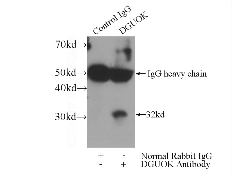 IP Result of anti-DGUOK (IP:Catalog No:109907, 3ug; Detection:Catalog No:109907 1:300) with mouse kidney tissue lysate 4000ug.