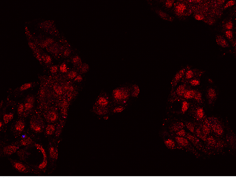 Human FOXP2 Immunofluorescence(IF) 15152