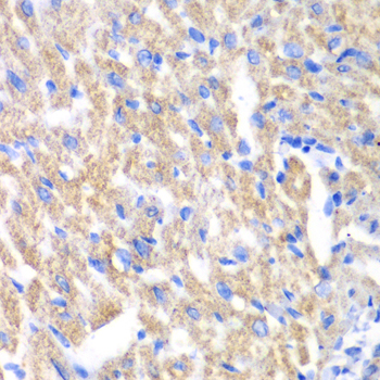 Immunohistochemistry - CREB3 Polyclonal Antibody 