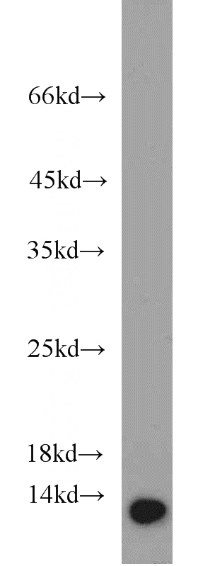 HeLa cells were subjected to SDS PAGE followed by western blot with Catalog No:107340(NUTF2 antibody) at dilution of 1:1000