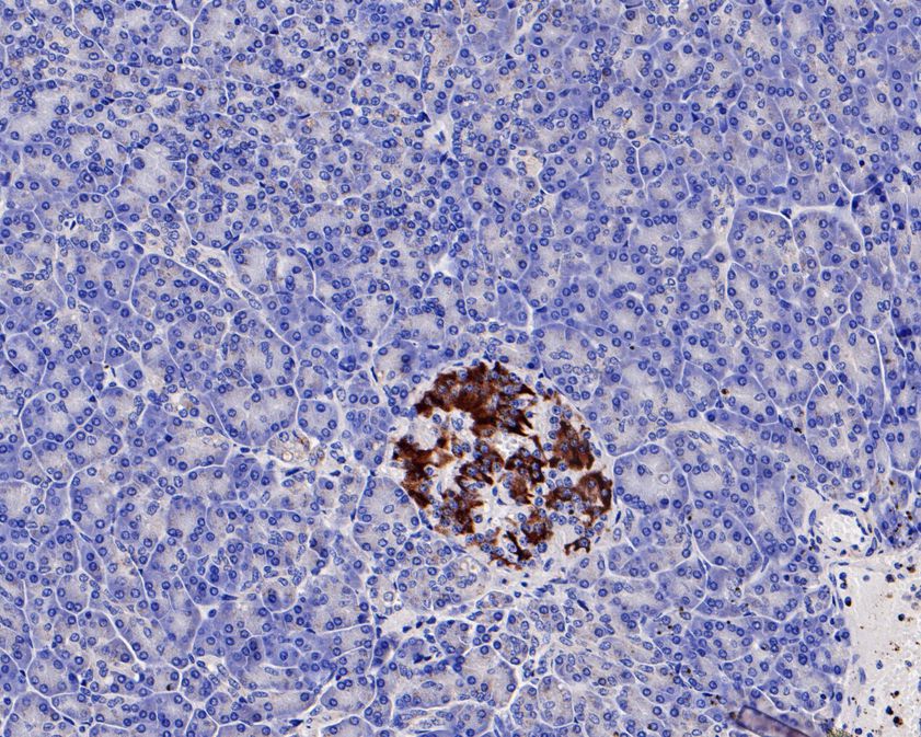 Fig4:; Immunohistochemical analysis of paraffin-embedded human placenta tissue using anti-PMP22 antibody. The section was pre-treated using heat mediated antigen retrieval with Tris-EDTA buffer (pH 8.0-8.4) for 20 minutes.The tissues were blocked in 5% BSA for 30 minutes at room temperature, washed with ddH; 2; O and PBS, and then probed with the primary antibody ( 1/50) for 30 minutes at room temperature. The detection was performed using an HRP conjugated compact polymer system. DAB was used as the chromogen. Tissues were counterstained with hematoxylin and mounted with DPX.