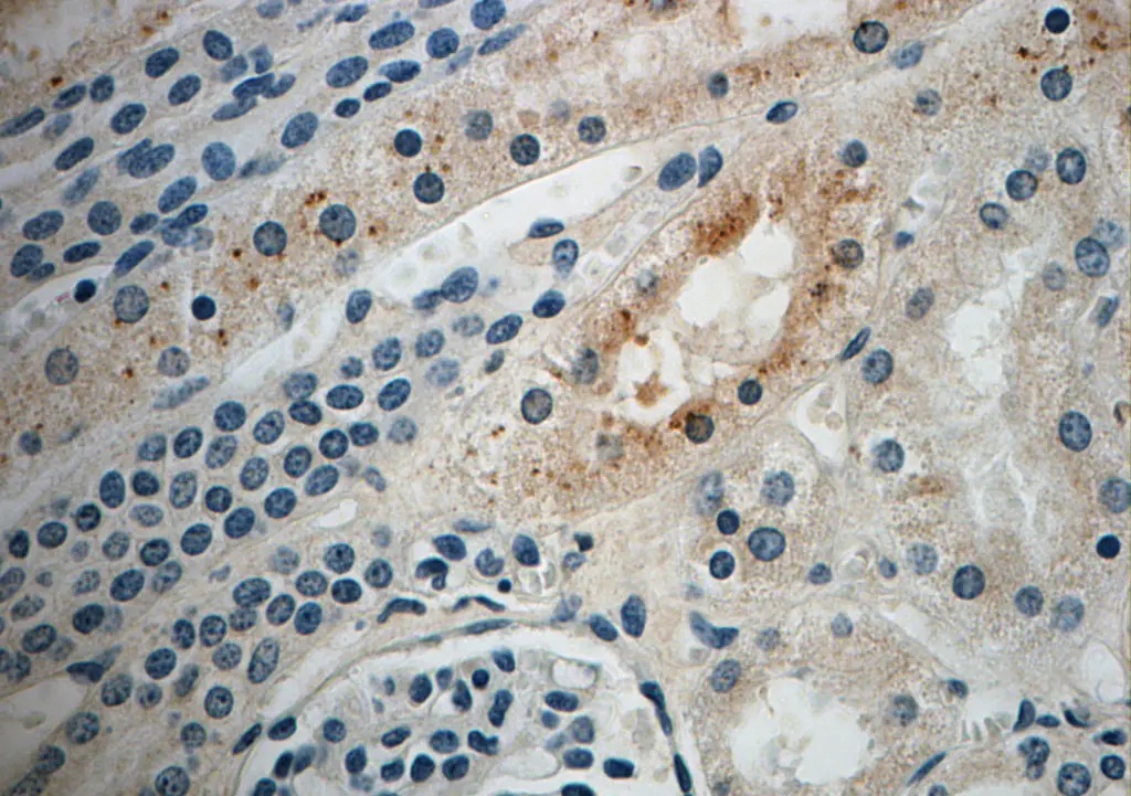 Immunohistochemistry of paraffin-embedded human kidney slide using Catalog No:115586(SRGAP2 Antibody) at dilution of 1:50